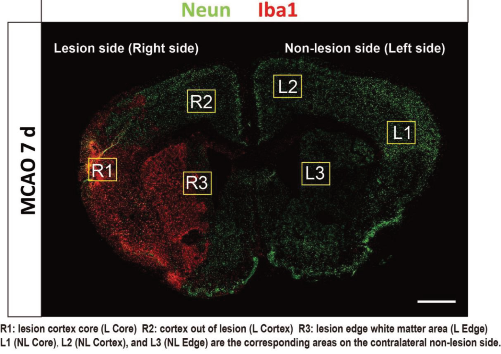 Section_Iba1_Neun